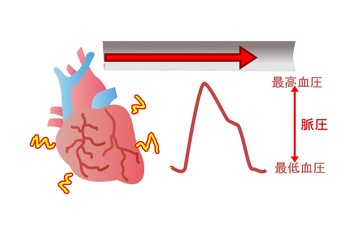 血圧メタル.jpg